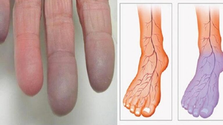 This simple remedy transforms poor circulation… discover how it works!
