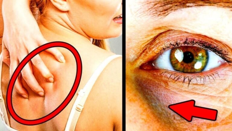 This simple sign reveals if you’re eating too much sugar…
