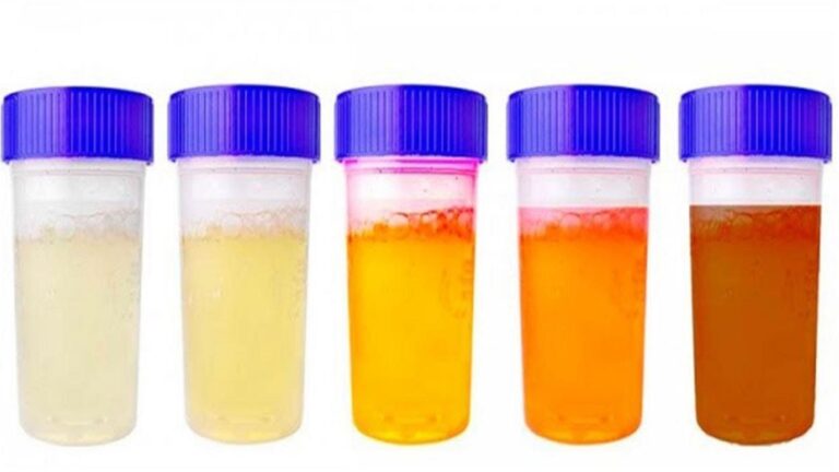 This simple observation about urine color reveals surprising truths about your health…