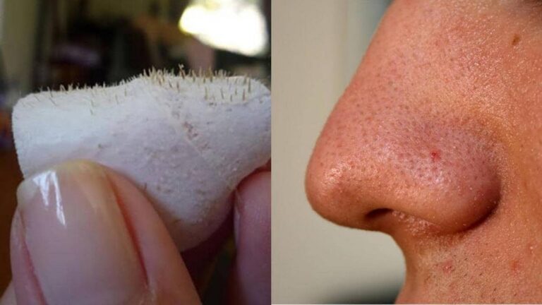 This simple gesture can transform your skin and remove blackheads…