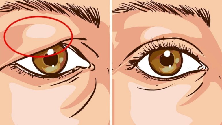 This surprising trick transforms droopy eyelids naturally and boosts your confidence…