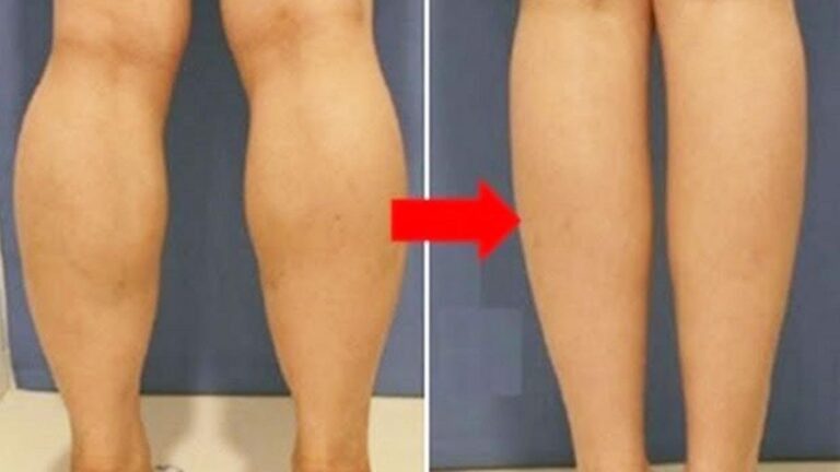 This simple trick transforms your legs in weeks… you’ll be amazed at the results!