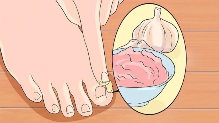 This simple trick transforms garlic into a powerful remedy… you’ll want to try it!