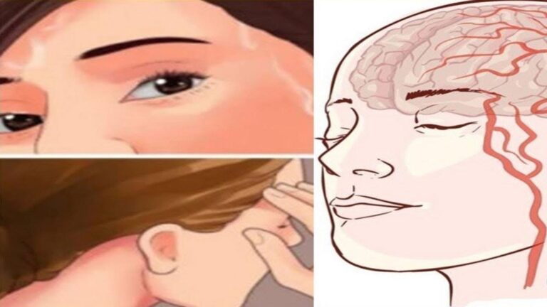 This simple gesture could reveal hidden signs of a stroke…