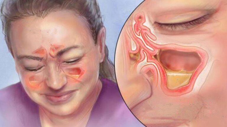 This forgotten trick clears up sinus pressure in minutes…