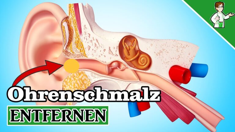 5 Easy Ways to Safely Remove Earwax at Home