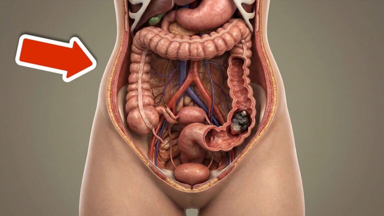 10 Common Symptoms of Colon Cancer Everyone Should Notice Now!