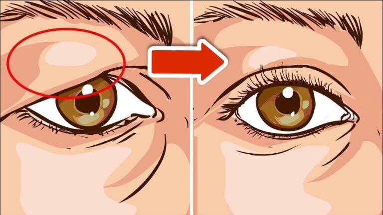 Erase Droopy Eyelids Instantly with These 5 Simple Tricks! 💥🤯
