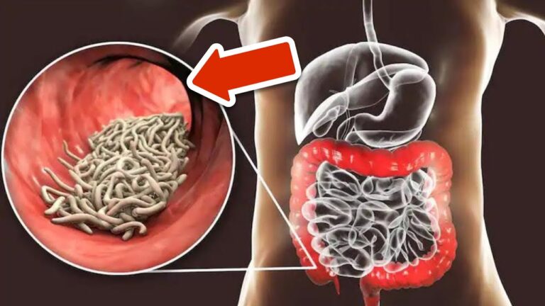 Eliminate Parasites: 2 Simple Spoonfuls for a Healthier Body!