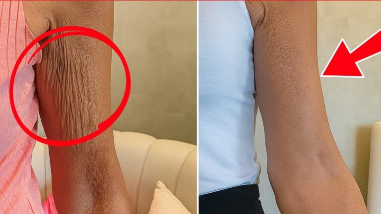 10 Quick Tips to Remove Wrinkled Skin with This Secret Method!
