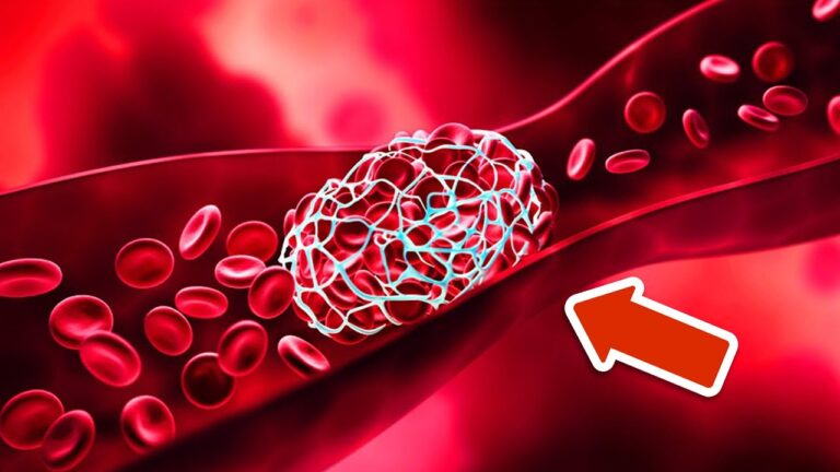 8 Fruits That Naturally Dissolve Blood Clots for Better Health!