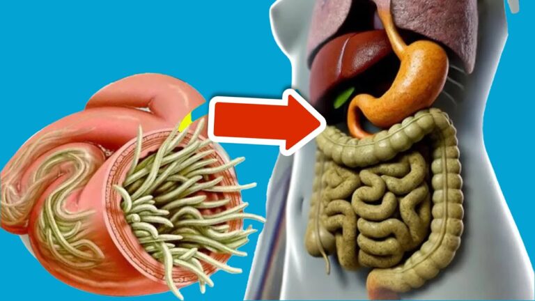 Eliminate 7 Gut Parasites Fast with These Foods That Work in Minutes!