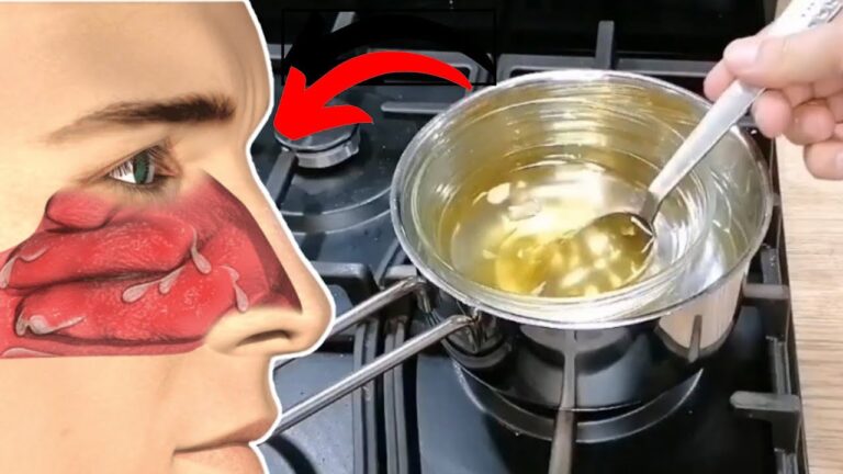 Remove Lung Mucus with 1 Tablespoon Daily for Better Breathing!