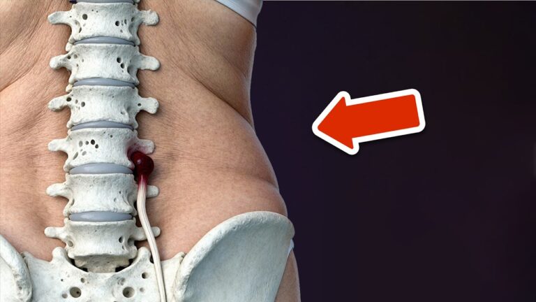 5 Common Mistakes Everyone Makes with Back Pain and How to Avoid Them!