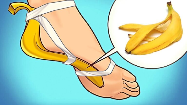 7 Incredible Benefits of Banana Peels You Need to Know!