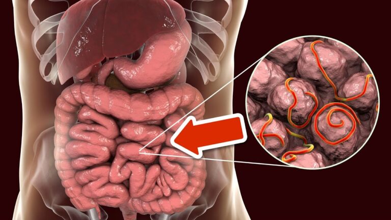 1 Cup a Day to Eliminate Parasites Forever – Discover the Secret!