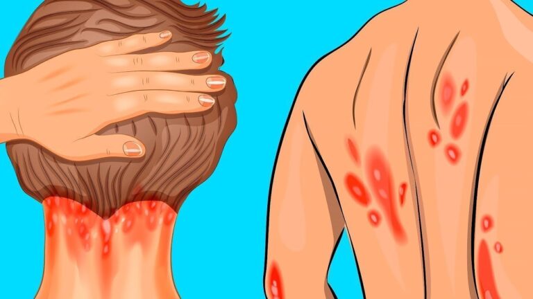 7 Crucial Signs You Might Have a Vitamin D Deficiency You Shouldn’t Ignore